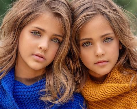Upbeat News Heres What “the Most Beautiful Twins In The World” Look Like Now