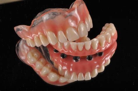 Cuidado Com A Dentadura 6 Dicas Simples Md Odontologia