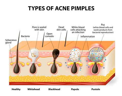 Pin on Health & Beauty