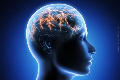 Was Passiert Bei Epilepsie Im Gehirn