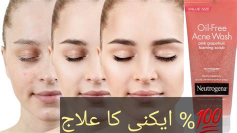 Neutrogena Oil Free Acne Face Wash Scrub Honest Review Acne Treatment Youtube
