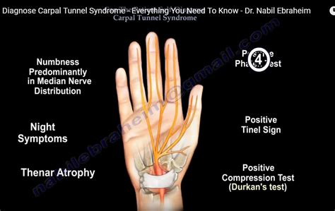 Signs And Symptoms Of Carpal Tunnel Syndrome —