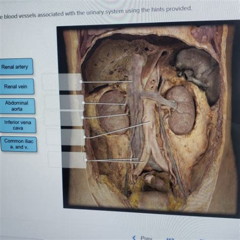 What is the name of artery c? Kidney Ureter perirenal fat Suprarenal gland Urinary ...