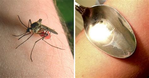 How To Get Rid Of Mosquito Bites Ways To Stop Mosquito Bite Itch