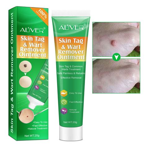 Buy Skin Tag Removal Warts Remover Cream Advanced Skin Tag Remover