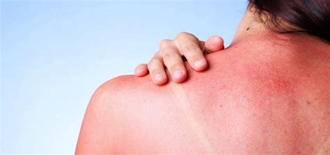 Cloro Irritazione Pelle ~ Prodotto Speciale Pulizia Viso Uomo