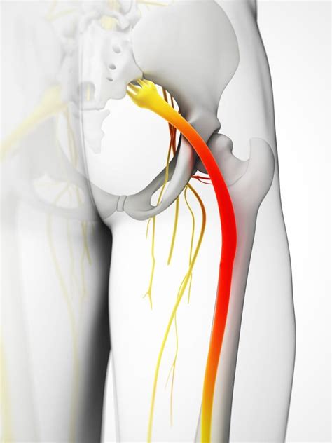 What You Need To Know Anatomy Of The Sciatic Nerve Spine Center Of Texasspine Center Of Texas