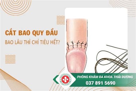 Cắt Bao Quy đầu Bao Lâu Thì Tiêu Hết Chỉ