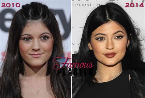 Kylie Jenner Fake Beauty Regiment Glorified Why Doesnt She Admit Plastic Surgery