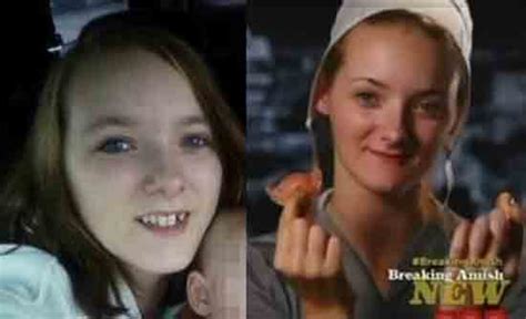 Breaking Amish Why Did Rebecca Lose Her Teeth At 19 Before And After