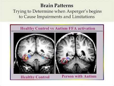 Maap services for autism, asperger syndrome, and pdd provides information, advice, and networking to families of more advanced. Asperger's Syndrome Just a Piece of the Puzzle - YouTube