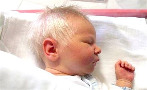 The particular pigment found in our skin and hair is melanin, of which there are two types: Baby Boy Born With All White Hair Stuns Doctors - Viral Murphy