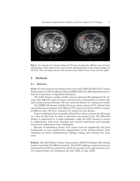 Automatic Segmentation Of Kidney And Liver Tumors In Ct Images Deepai