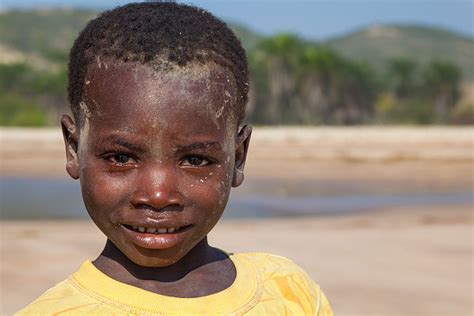 Vielen menschen mit krankheitssymptomen gelang es nicht, sich testen zu lassen. 2016 - Lesotho, Südafrika, Angola - mantoco.com