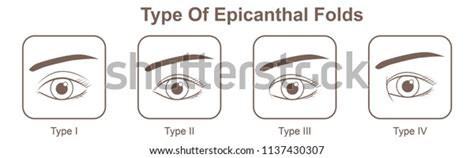 1 Medial Canthal Fold Images Stock Photos And Vectors Shutterstock