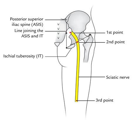 Easy Notes On 【sciatic Nerve】learn In Just 4 Minutes