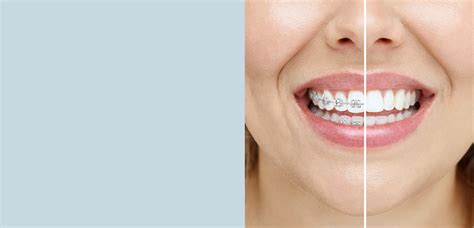 Treatment Options - Smile Dental