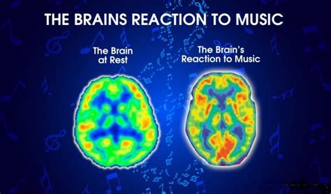 How Music Affects Your Brain Enterprise