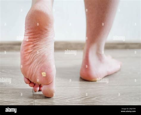 Illness Malady Hi Res Stock Photography And Images Alamy