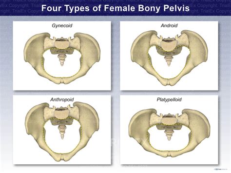 Four Types Of Female Bony Pelvis Trialexhibits Inc