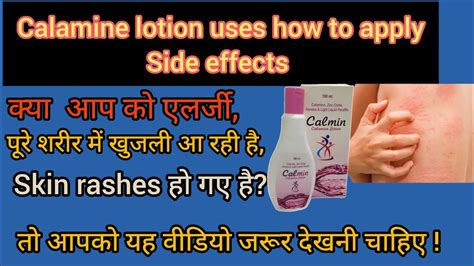 Calamine Lotion Uses Side Effects How To Apply Urticaria Treatment