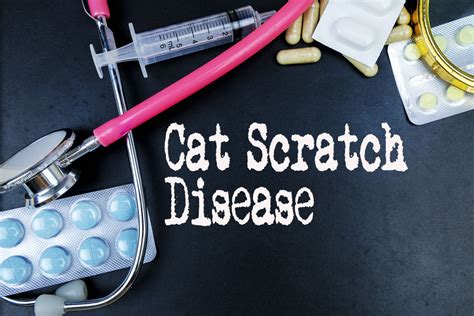 10 Symptoms And Treatments For Cat Scratch Disease Facty Health