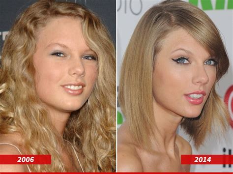 Taylor Swift Good Genes Or Good Docs Plastic Surgery Taylor Swift