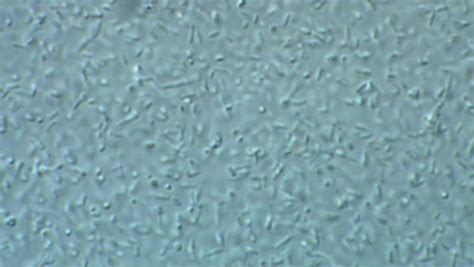 Light Microscope Footage Of Escherichia Coli Bacteria Moving Around