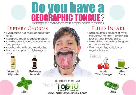 Home Remedies For Geographic Tongue Top 10 Home Remedies