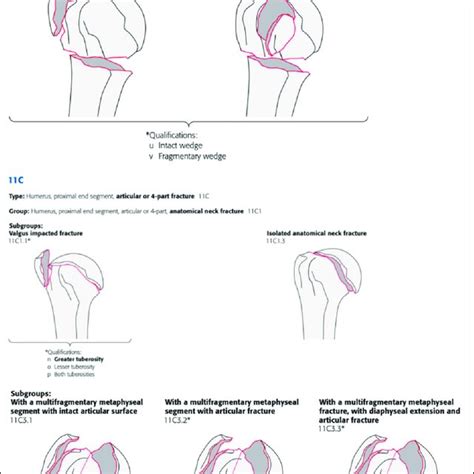 AO OTA Classification Of Proximal Humerus Fractures Reproduced With Download Scientific