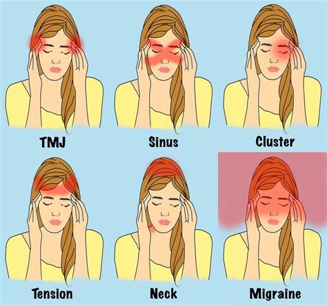 Do You Know Headaches Are Of Different Types And Each Has Some Health