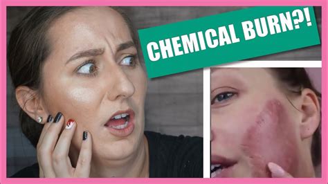 Let's watch it happen together!🌈 win a chance to be flown with a friend to meet me!!!! Chemist Reacts DIY Chemical Peel Gone Wrong! - YouTube