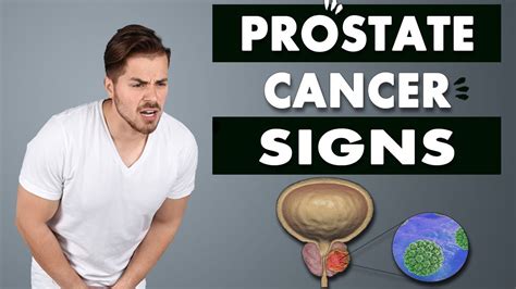 Prostate Cancer Signs And Symptoms Of Prostate Cancer Youtube
