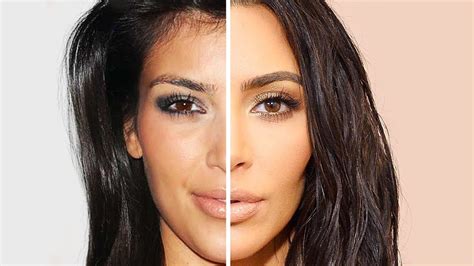 Kim Kardashian Plastic Surgery Before And After