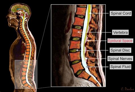 Lumbar Spine Mri Mri Scan Images