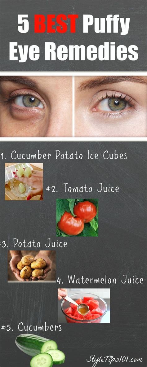 Tea bags tend to work well for puffy and irritated eyes. 5 Best Puffy Eye Remedies | Puffy eyes remedy