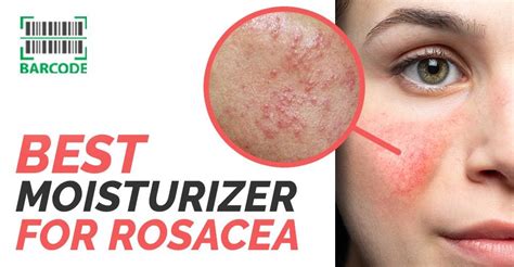 Best Moisturizer For Rosacea According To Experts Updated