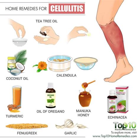 Cellulitis Lower Leg Pain