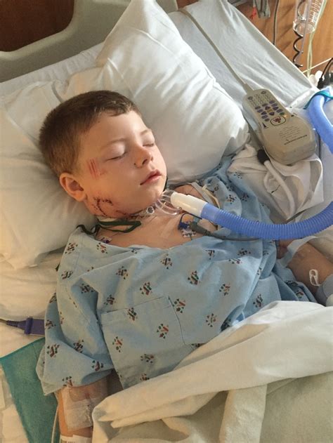 Second Pit Bull Attack On A Child In A Week