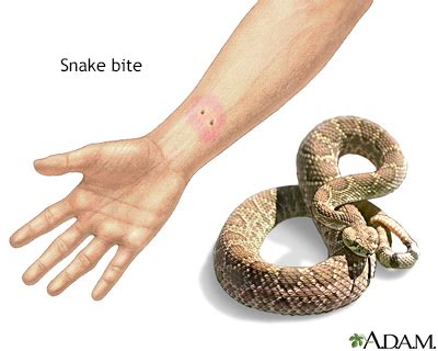 Pictures Of Non Poisonous Snake Bites Snake Poin