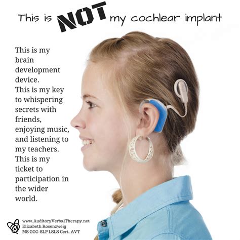 Cochlear Implants How They Work And What They Can Do Icphs