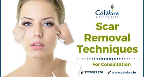 Scar Removal Important Techniques And Treatment
