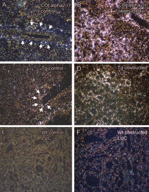 In Situ Hybridization Ish For Collagen 2 I And Luciferase Using 35 Download Scientific