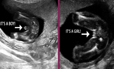 Gender Reveal Ultrasound Gender Reveal Ultrasound Baby Gender