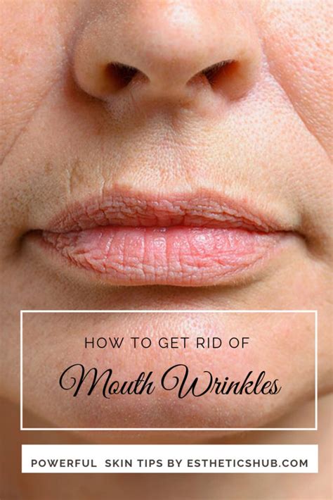 How To Get Rid Of Wrinkles Around Your Mouth