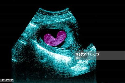 11 Week Fetus Photos And Premium High Res Pictures Getty Images