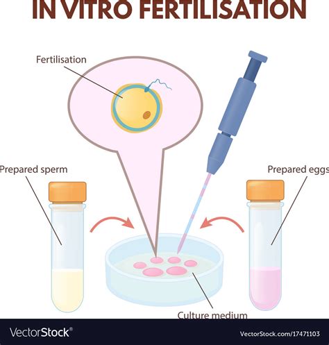 In Vitro Fertilization Royalty Free Vector Image