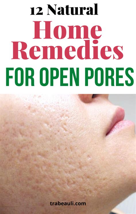 20 Home Remedies To Get Rid Of Open Pores On Skin Artofit