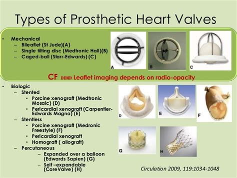 Role Of Cinefluoroscopy In Prosthetic Valve Disease