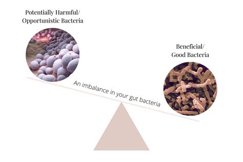 What Is Gut Dysbiosis Plus Associated Conditions Prana Thrive